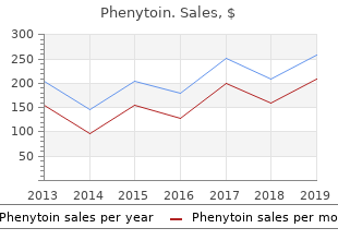 order phenytoin us