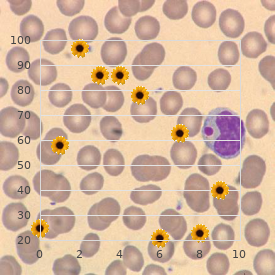 Free sialic acid storage disease