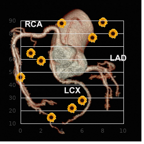 Hypokalemic alkalosis with hypercalcinuria