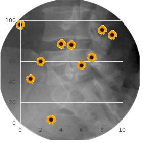 Vertebral body fusion overgrowth