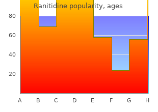 order ranitidine 150mg without prescription