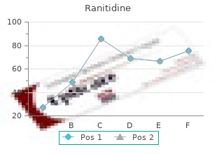 order ranitidine in india