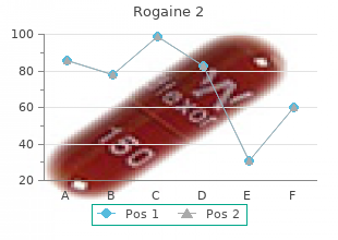 purchase rogaine 2 online from canada