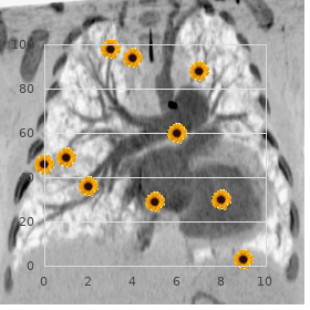 Aldred syndrome