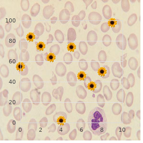 Molluscum contagiosum