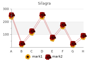 buy silagra 50mg fast delivery