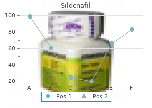 sildenafil 75mg with mastercard