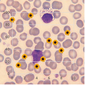 Galactokinase deficiency