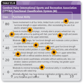 Occlusive Infantile ateriopathy