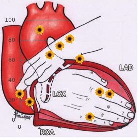 X-linked mental retardation type Raynaud