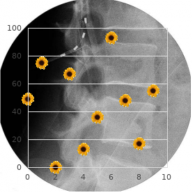 Branchial arch syndrome X linked