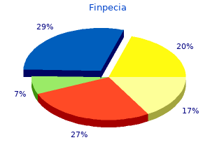 buy 1 mg finpecia amex