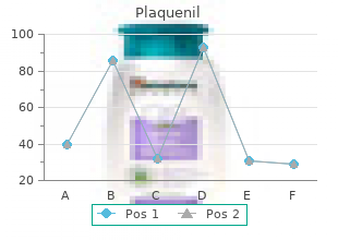 plaquenil 200mg overnight delivery