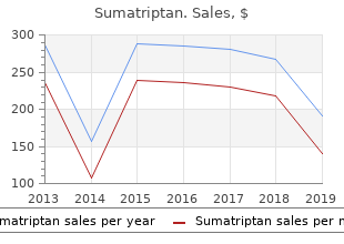 purchase on line sumatriptan