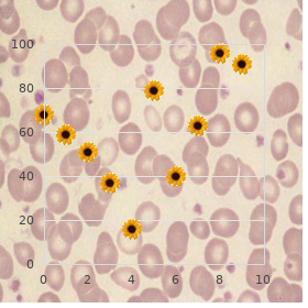 Dilated cardiomyopathy: Cardiomyopathy dilated with conduction defect type 1, Cardiomyopathy dilated with conduction defect type 2, Cardiomyopathy, familial dilated