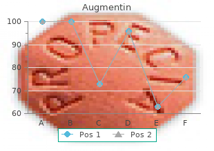 order augmentin 375mg with mastercard