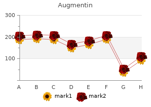 purchase 375mg augmentin with mastercard