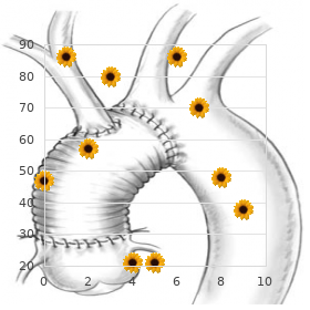 Chromosome 14 trisomy