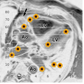 Hereditary amyloidosis