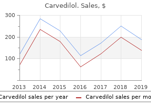 discount carvedilol amex