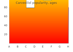 buy carvedilol with visa