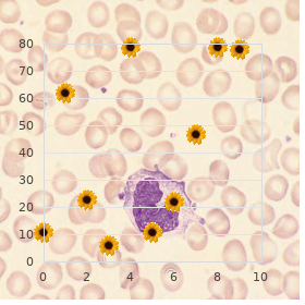 Methylcobalamin deficiency, cbl E complementation type