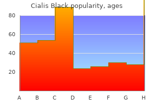 cheap cialis black 800mg without prescription