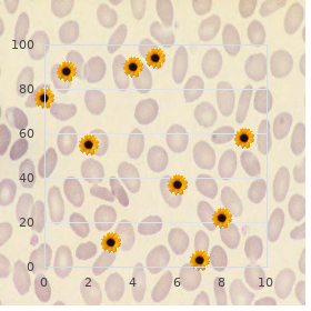 Spinal muscular atrophy type 3