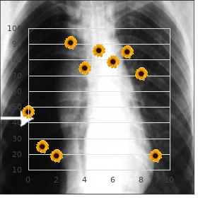 Chromosome 14 ring