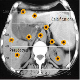 Achalasia alacrimia syndrome