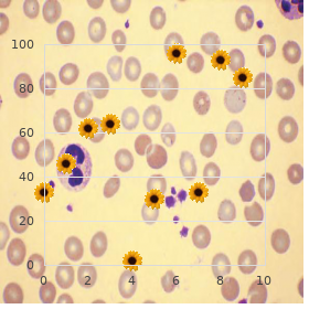 Van der Woude syndrome 2