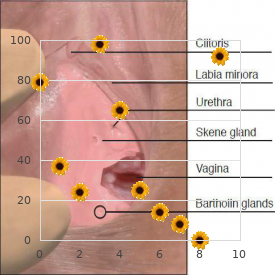 Amenorrhea