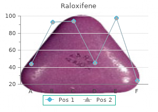 buy 60 mg raloxifene free shipping