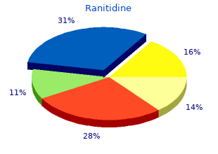 300mg ranitidine