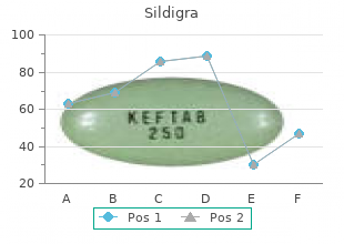 purchase 120mg sildigra with visa