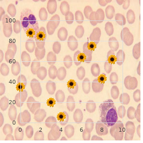 Hay Wells syndrome recessive type