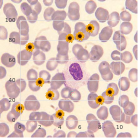 Hamano Tsukamoto syndrome