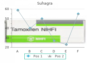 buy suhagra 100mg on line