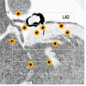 Hereditary primary Fanconi disease