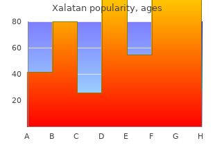 cheap 2.5  ml xalatan free shipping