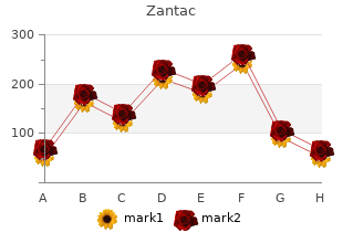 150 mg zantac sale