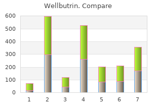 discount wellbutrin 300 mg free shipping