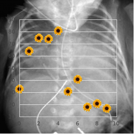 Facial dysmorphism macrocephaly myopia Dandy Walker type