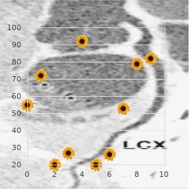 Myopathy Moebius Robin syndrome