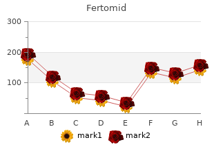 50 mg fertomid amex