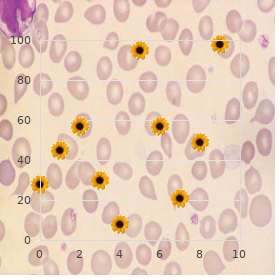 Lambdoid synostosis familial