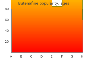 buy generic butenafine pills