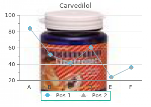 cheap carvedilol 25mg on line