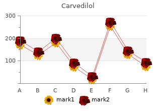 buy carvedilol cheap