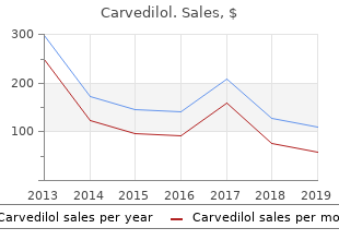 buy carvedilol 6.25mg low price